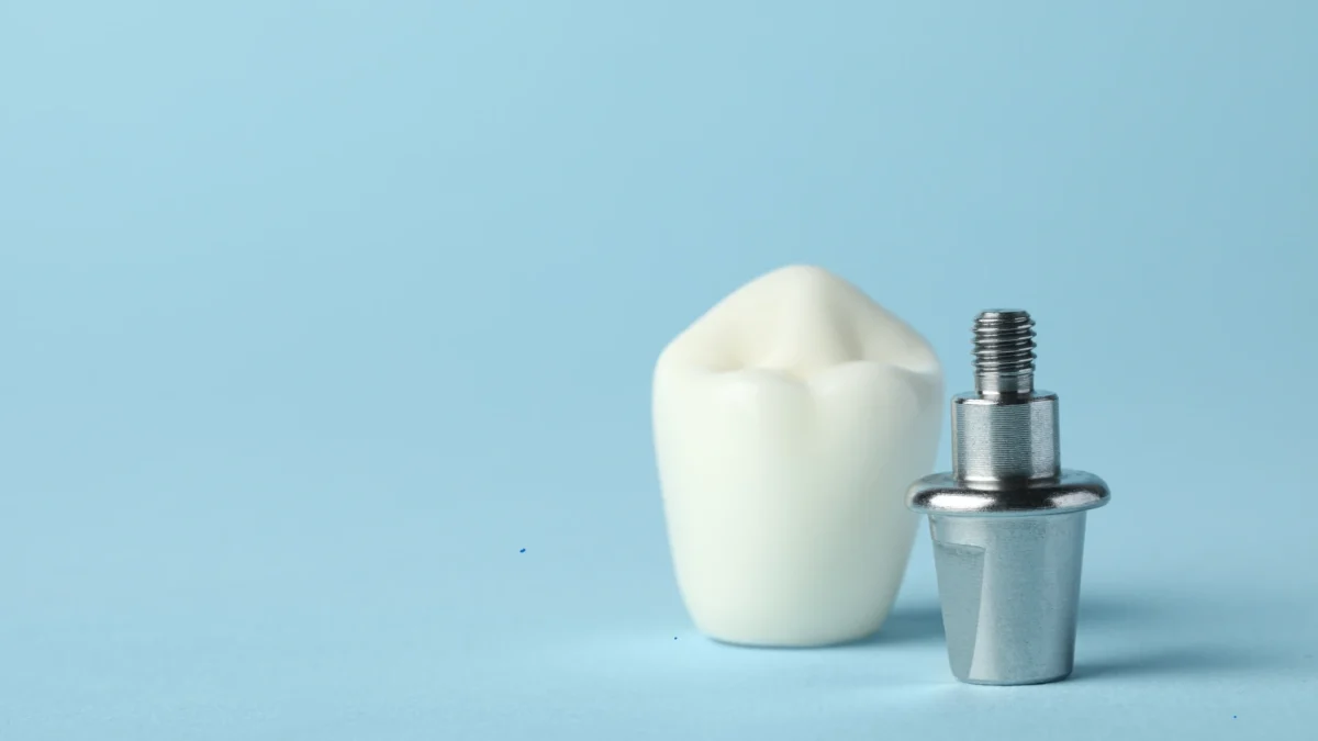 tipuri implanturi dentare - bontul protetic rol esential in succesul implantului dentar