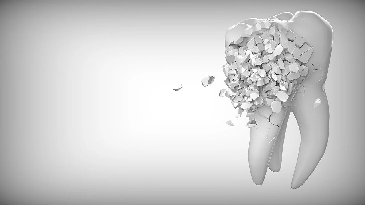 complicatii retragere gingii ce riscuri determina retractia gingivala