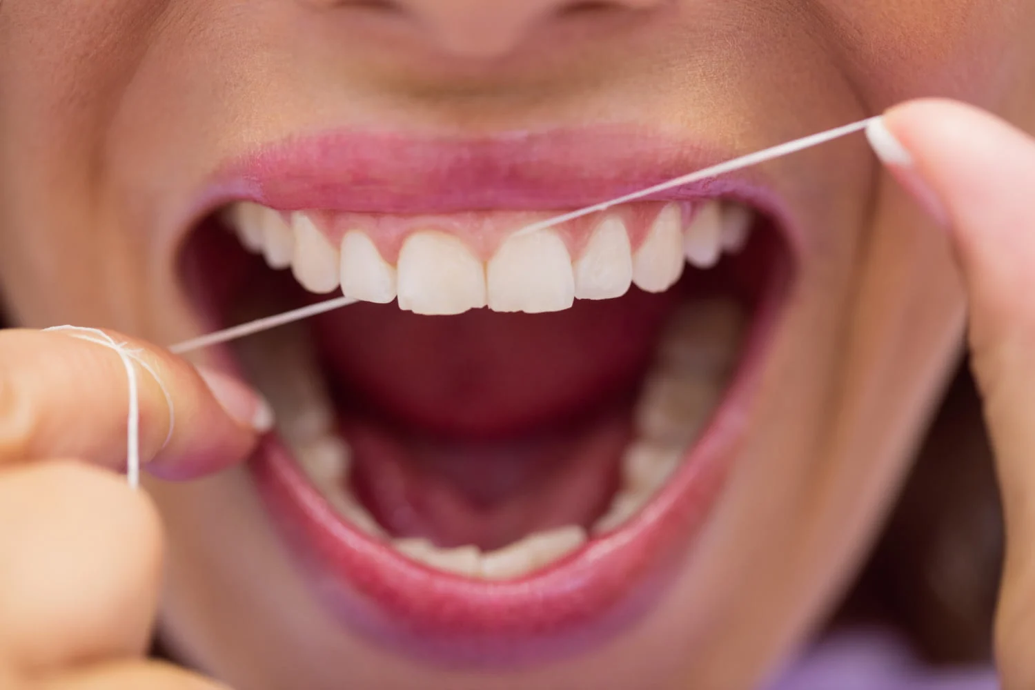 cum prevenim retractia gingivala igiena orala corespunzatoare si vizitele frecvente la stomatolog previn aparitia retractiei gingivale