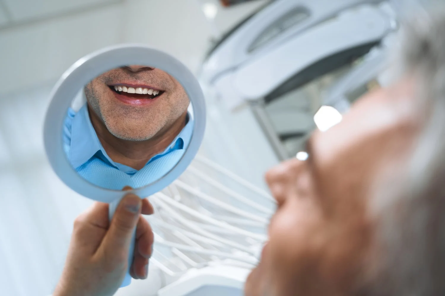 tipuri fatete dentare